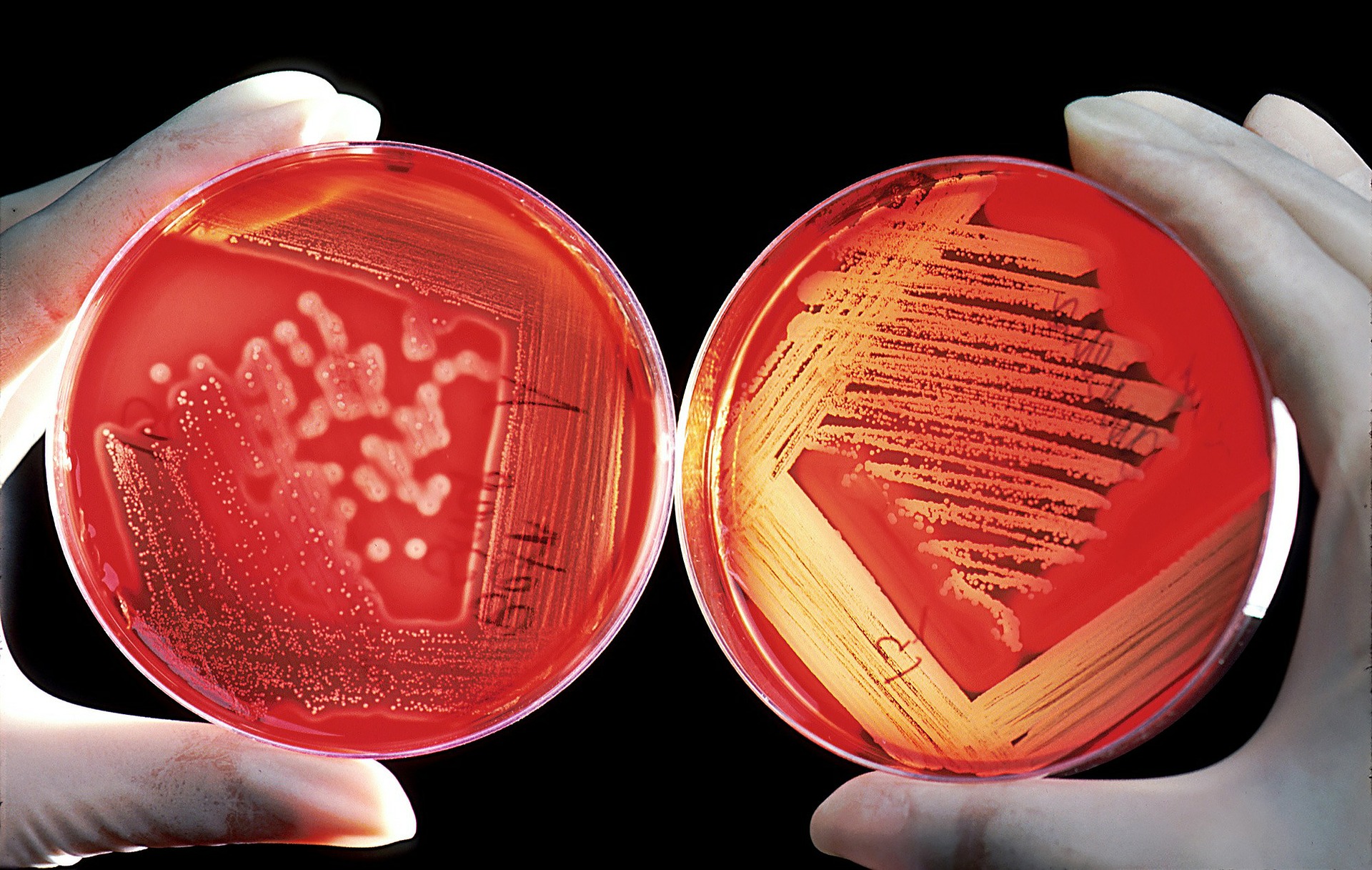 Crecimiento en cultivos de bacterias y otra microbiota intestinal.