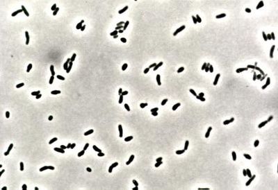 Imagen de Corynebacterium glutamicum. Este género de bacterias resulta fácilmente reconocible al microscopio por presentar una estructura característica en forma de “V” o letras chinas. Imagen de Corynebacterium glutamicum. Este género de bacterias resulta fácilmente reconocible al microscopio por presentar una estructura característica en forma de “V” o letras chinas.