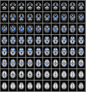Cómo varía la sangre en el cerebro con la droga, mostrado por el escáner. (Atribución de la imagen del escáner a PNAS)