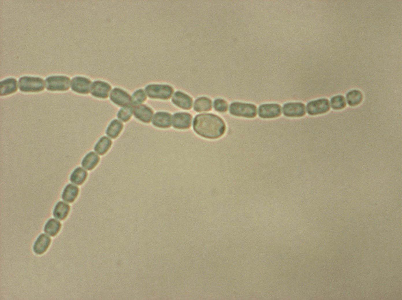 Anabaena vista a 100x aumentos en medio BG110 (ausencia de N) tras 10 días Anabaena vista a 100x aumentos en medio BG110 (ausencia de N) tras 10 días