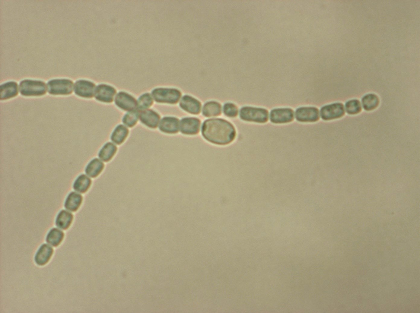 Anabaena vista a 100x aumentos en medio BG110 (ausencia de N) tras 10 días