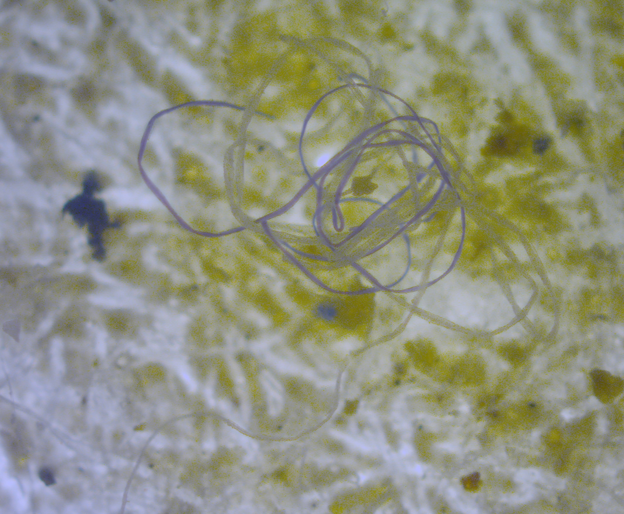 En la imagen podemos ver una fibra de microplástico al microscopio (Trabajo propio de M.Danny25, Wikipedia).