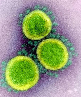 Partículas del virus SARS-CoV-2 vistas con el microscopio electrónico de transmisión. / NIAID (National Institute of Allergy and Infectious Diseases).