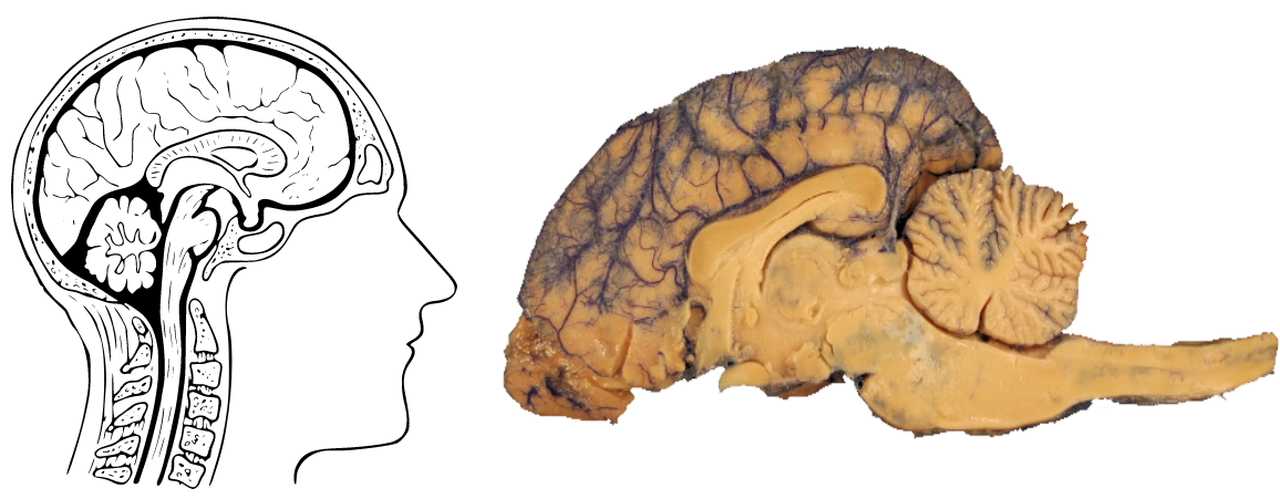 Si comparamos el cerebro de un ser humano con el cerebro de un perro, anatómicamente encontraremos las mismas regiones cerebrales, si bien lo que cambia es su nivel de desarrollo. Cabe decir que no tiene que ver con el tamaño del cerebro o el número de neuronas la complejidad conductual que de este cerebro pueda producirse, sino, más bien, de la proporción neocórtex/encéfalo total y el número de conexiones que se realizan en según qué áreas. Con todo, la estructura encefálica común entre los mamíferos y que compartimos en gran parte con las aves explica los refinados comportamientos y procesos emocionales que presentamos en comparación con, por ejemplo, la mayor parte de invertebrados.