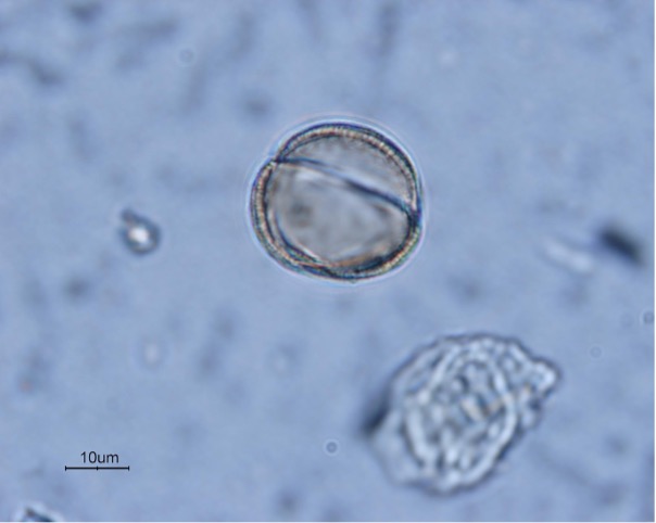 Grano de polen de Prunus cerasifera. A diferencia de los granos de polen de las especies terrestres, polinizadas por insectos o el viento, que muestran perfiles más o menos esféricos, los granos de polen de las especies hidrófilas son aplanados (discoidales) o en forma de bastoncillos. Éstos se agregan forman estructuras más o menos filamentosas que facilitan la posibilidad de fecundación. Imagen tomada de la base de datos Global Pollen Project.