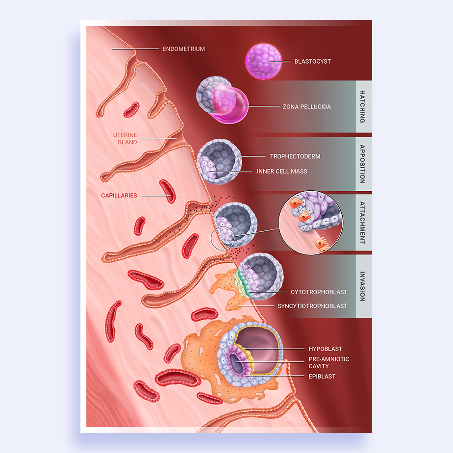 La ilustración no sólo acompaña un artículo científico, también se publica en medios ‘populares’ como las redes sociales, por ende, se jerarquiza la información para facilitar la lectura, se cuida la estética y rigurosidad para generar alto impacto y se señalan los elementos para comunicar a un público diverso. Human blastocyst implantation sequence (implantación de blastocisto humano en útero). Human blastocyst implantation sequence. Oxford Academy, Volume 27-Issue 3. Cliente: Institute for Bioengineering of Catalonia - IBEC. ©Giselle Vitali