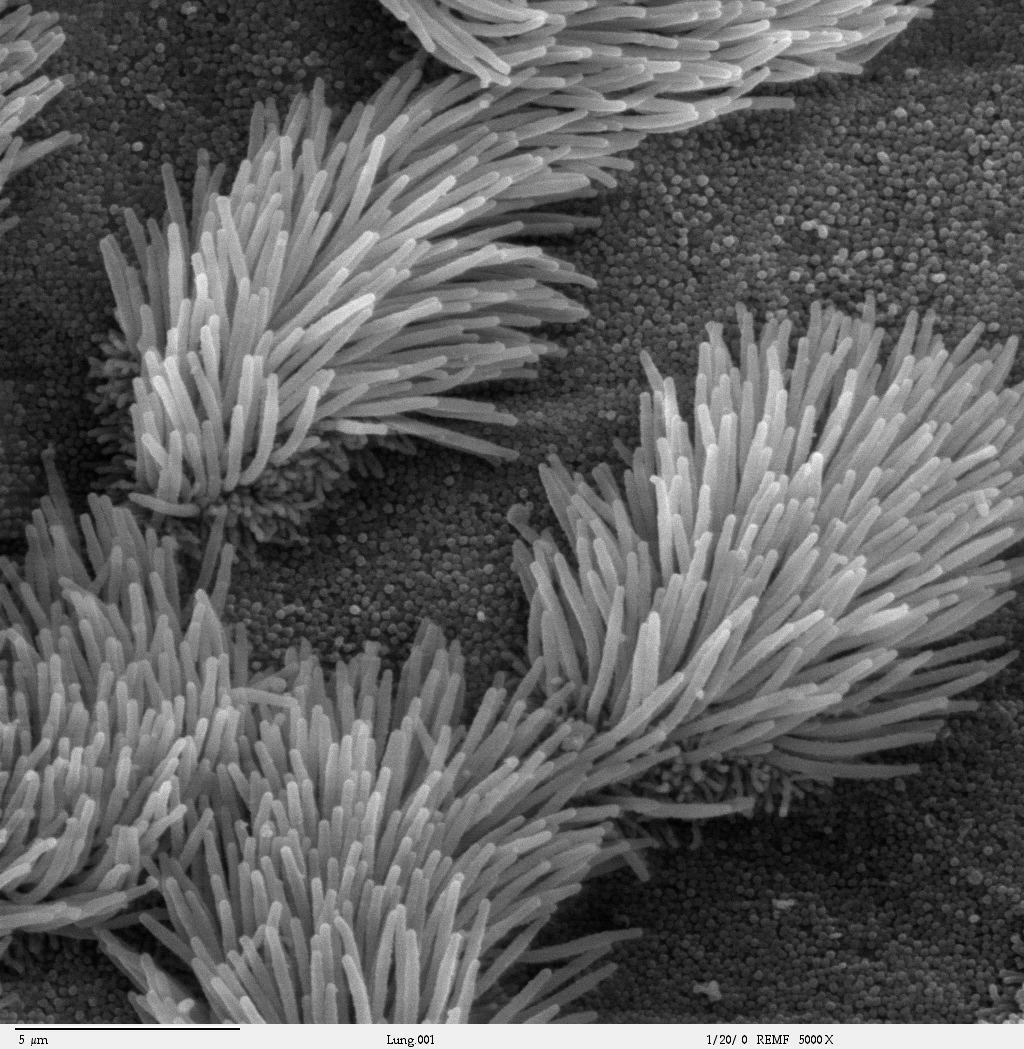 Imagen de microscopio electrónico de barrido del epitelio de la tráquea pulmonar. Hay células ciliadas y no ciliadas en este epitelio. Se aprecia la diferencia de tamaño entre los cilios y las microvellosidades (en la superficie celular no ciliada).
