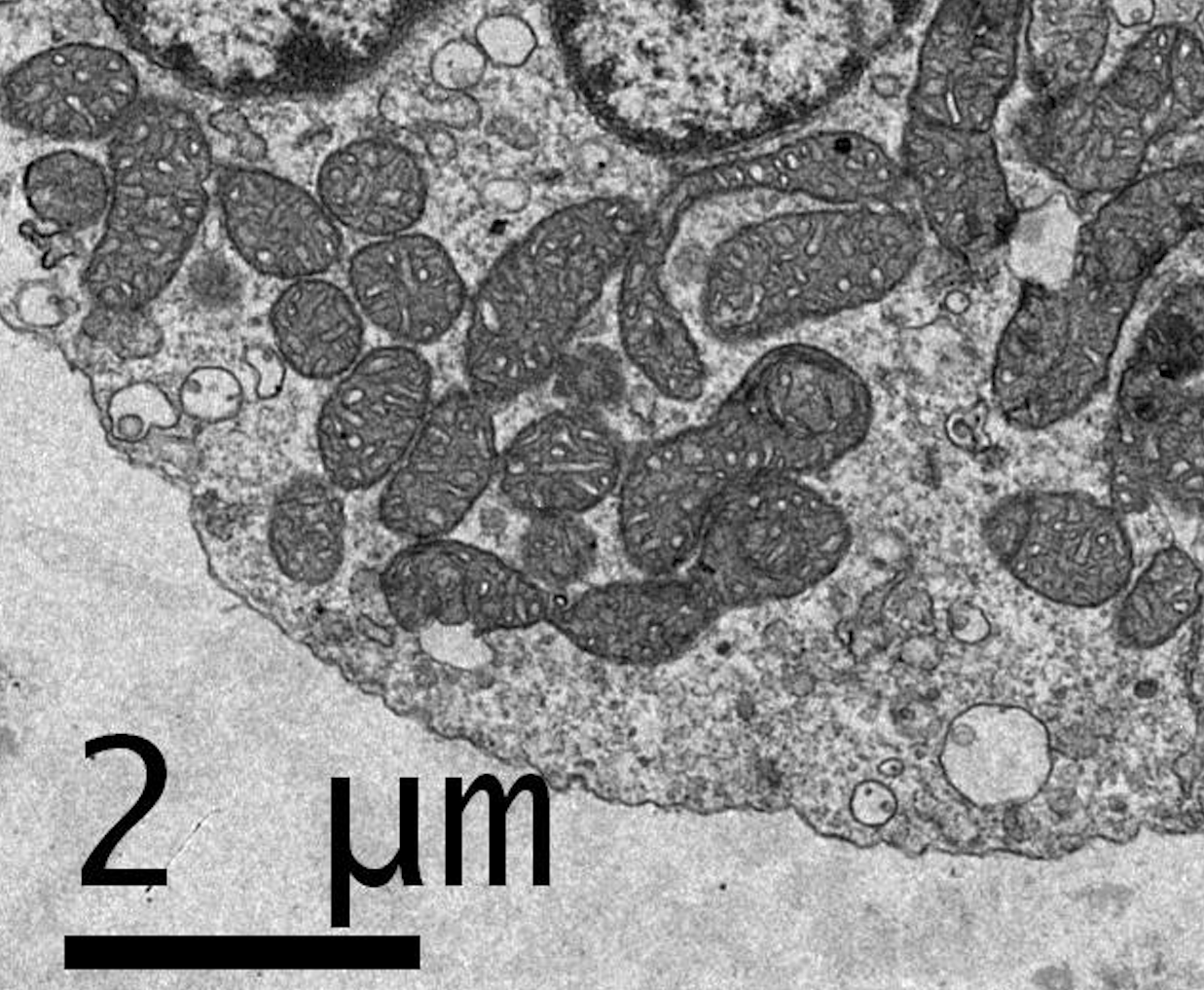 Imagen de mitocondrias realizada con microscopio electrónico de transmisión