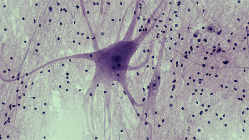 Neurona piramidal al microscopio óptico. Se pueden apreciar muchos núcleos celulares más pequeños que corresponden con células gliales que asisten a la gran neurona del centro de la imagen. Como puede apreciarse, son muchísimo más numerosas.