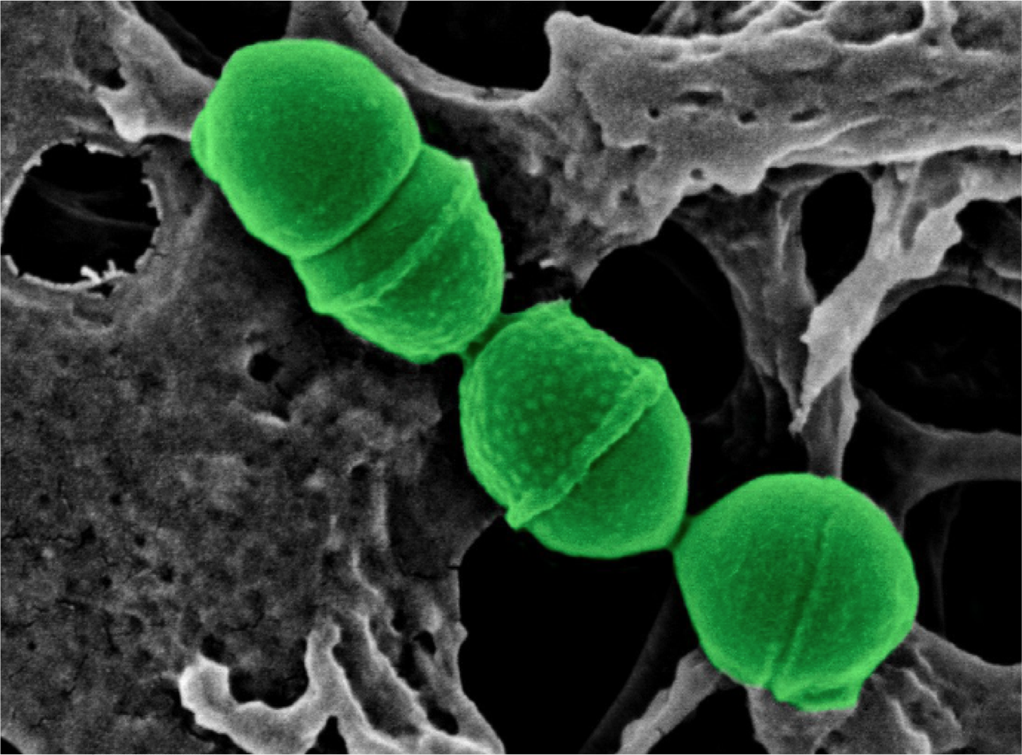 Streptococcus dentisani