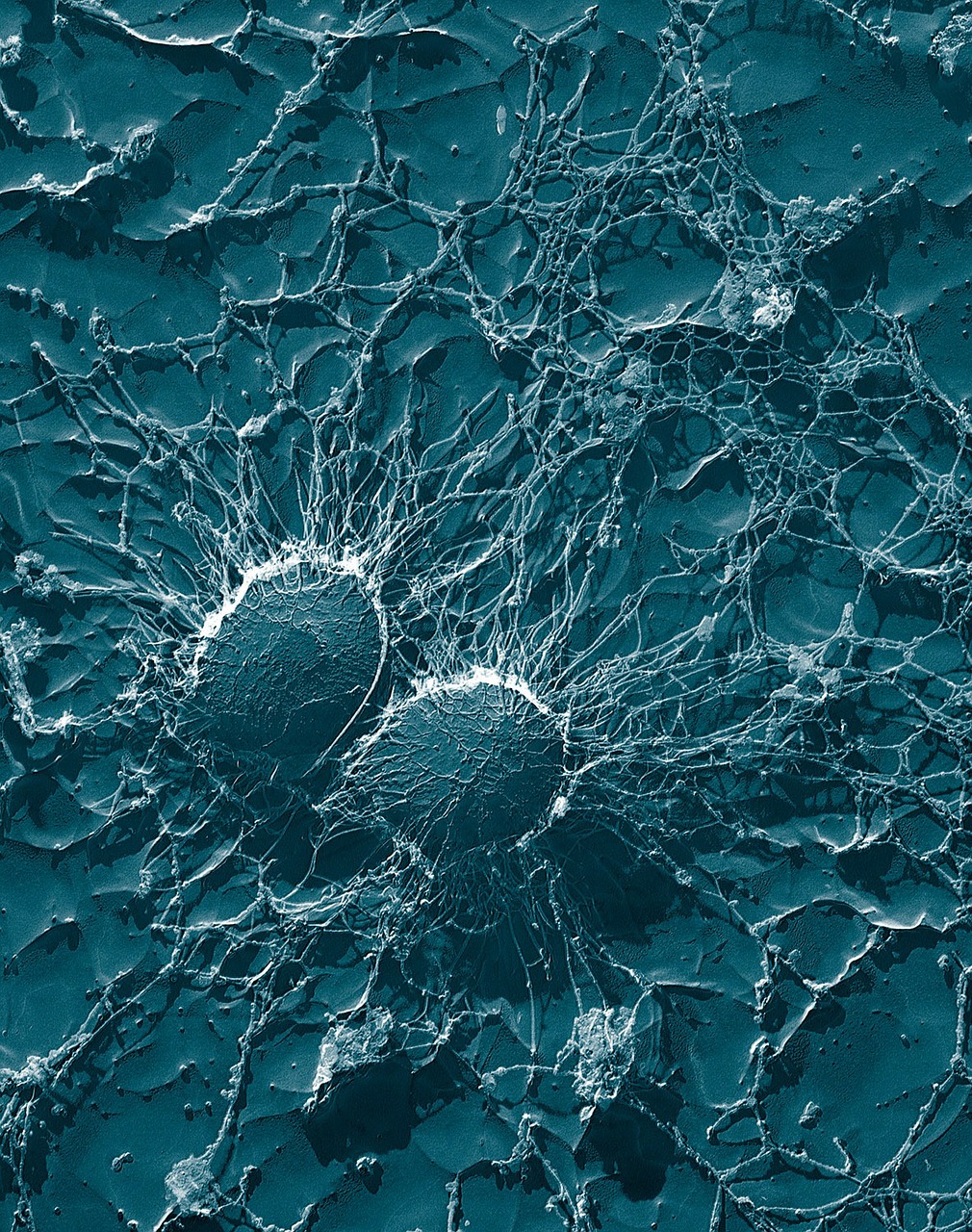 La gran cápsida de la bacteria Staphylococcus aureus le sirve para protegerse frente a los antibióticos