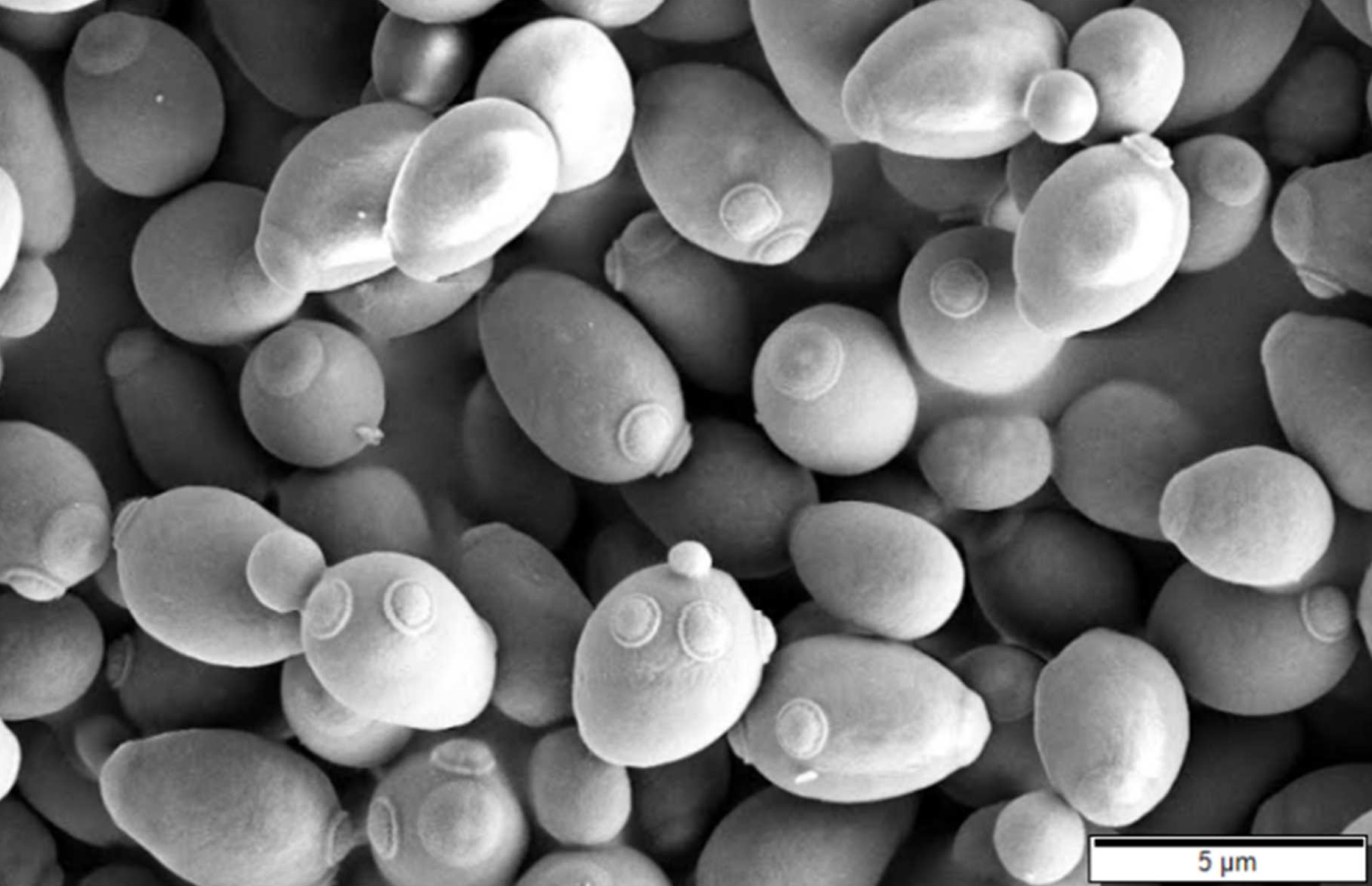 Esta levadura con forma redondeada recibe el nombre de Saccharomyces cerevisiae, cuyo epíteto específico hace referencia a su intervención durante la fermentación de la cebada para producir cerveza. Aparte de este anecdótico uso, el genoma de esta levadura fue descrito en 1996 y se ha convertido en un organismo modelo debido a la facilidad que presentaba el estudio de la conexión entre los genes y las proteínas. Gracias a esto, se han podido llevar a cabo múltiples estudios acerca de la función bioquímica de los genes, permitiendo entender las consecuencias biológicas de los fallos producidos por mutaciones. Imagen por Mogana Das Murtey y Patchamuthu Ramasamy. 