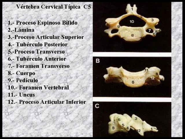 Processus Transversus Vertebrae. Imagen de una vértebra cervical donde aparece señalada arriba a la derecha la apófisis transversa, vestigio entre los mamíferos de las costillas cervicales. Modificado a partir de Anatomía de Gray