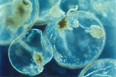 Noctiluca scintillans observada al microscopio óptico. Por Maria Antónia Sampayo, Instituto de Oceanografia, Faculdade Ciências da Universidade de Lisboa.