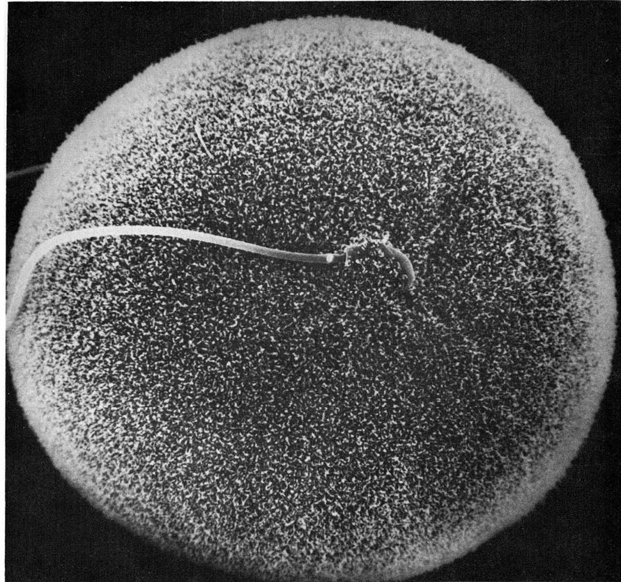 Micrografía en la que se aprecia la diferencia de tamaño entre ambos gametos, la evolución de los animales ha favorecido que se aumente la diferencia de tamaño.