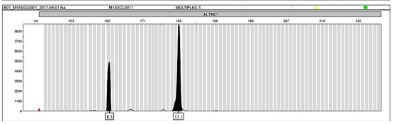 Un ejemplo de la observación de regiones microsatélite amplificadas por PCR. En este caso, se observan dos alelos distintos para la región y el parásito en cuestión