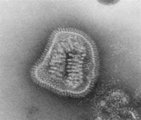 En esta imagen a microscopio electrónico de transmisión se puede ver una partícula completa de influenzavirus o virus de la gripe, observándose una cápsula con multitud de proteínas en su superficie (que funcionan como moléculas de reconocimiento para el sistema inmunitario) y el ácido nucleico en su interior.