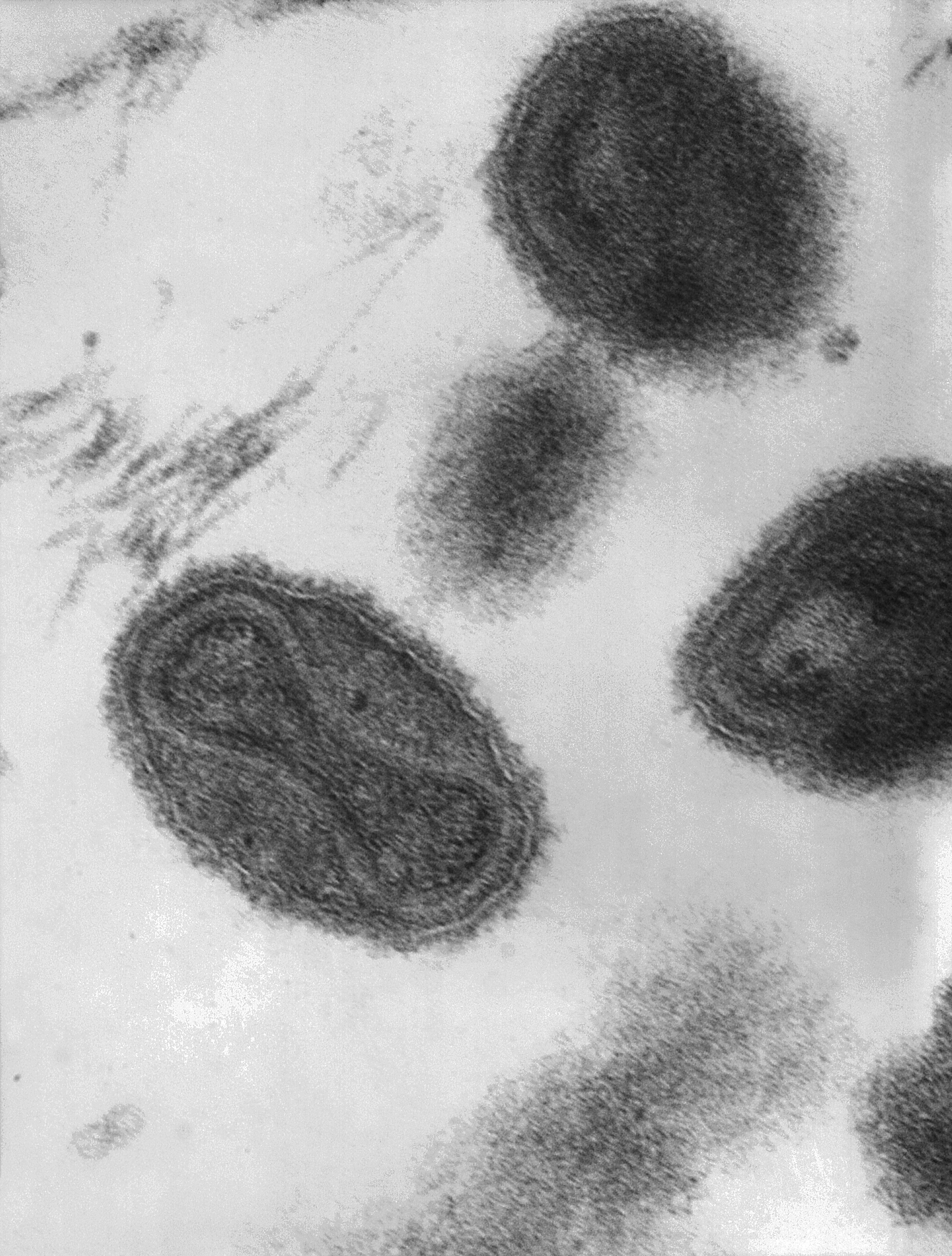 Virus de la viruela (Viruela). Dentro del virión podemos ver una especie de estructura con forma de mancuerna, se trata del material genético del virus, que es ADN. En la imagen podemos ver una micrografía al microscopio electrónico de transmisión (TEM) a 370.000 aumentos.