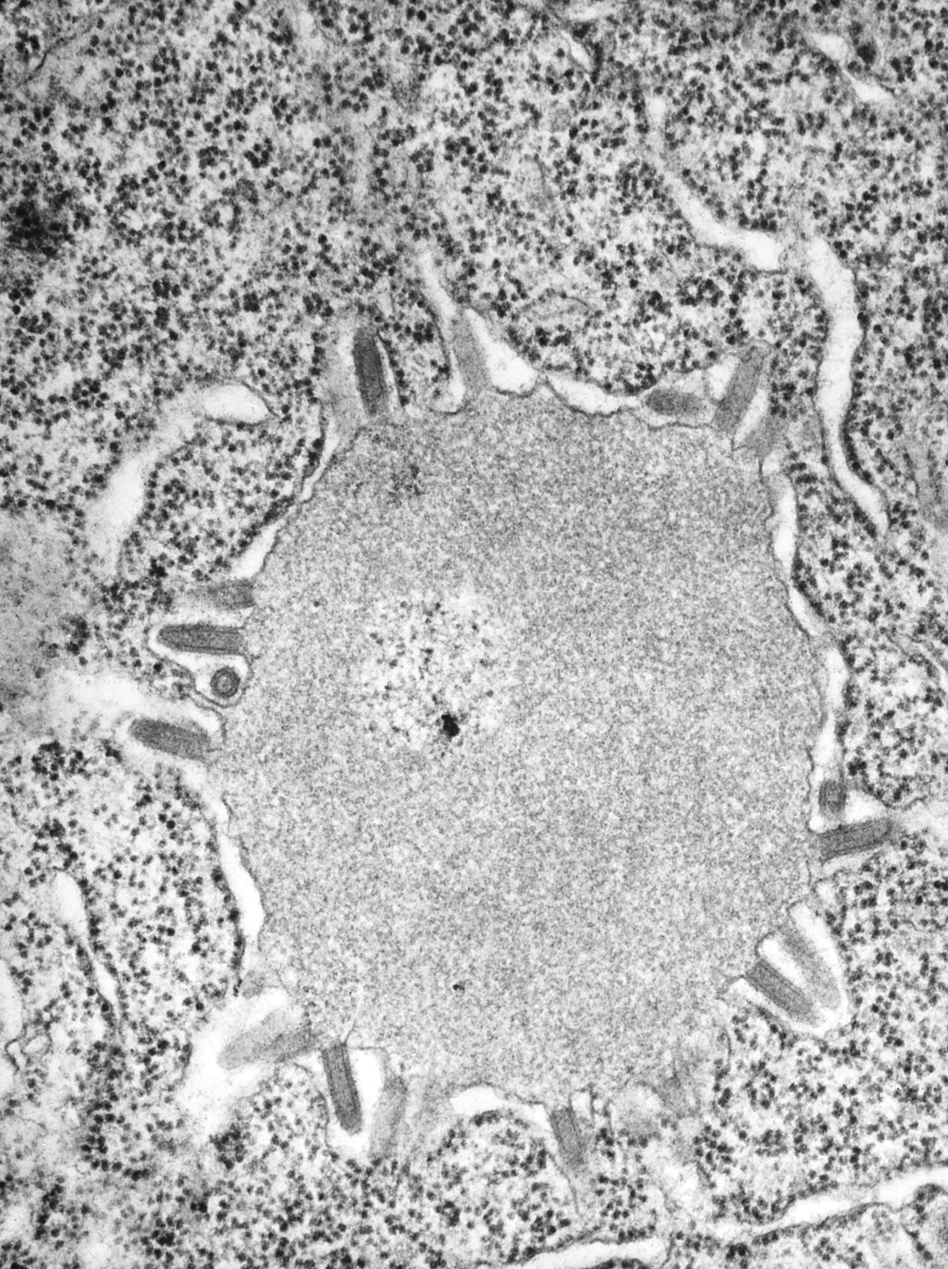 Lisavirus europeo de murciélago tipo I (EBLV-I) se trata de un virus de ARN monocatenario negativo de la familia Rhabdoviridae (Grupo V según la clasificación de Baltimore) que infecta a murciélagos y puede producir rabia en humanos. No confundir con la rabia canina, ya que esta es producida por el virus de la rabia. Es común que los murciélagos estén infectados por este tipo de virus que producen rabia en humanos, pero nada más allá de ser alarmante, es raro que nos muerda un murciélago si no lo tocamos y, si esto ocurre, los tratamientos son efectivos y con alta probabilidad de éxito. 
