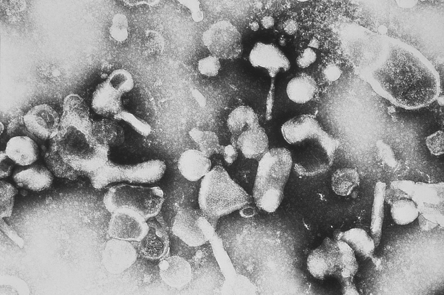 >El virus de la leucemia felina (VLFe) se trata de un retrovirus (género Gammaretrovirus de la familia Retroviridae) que infecta a gatos. Pertenece al Grupo IV según la clasificación de Baltimore y su material genético es ARN monocatenario que se retrotranscribe. Se transmite desde la saliva a las secreciones nasales de los mismos, y como podemos intuir con su nombre, produce leucemia. La leucemia es un cáncer que afecta a células de la sangre de los gatos, en concreto a los linfocitos, que son los encargados de defenderlo de agentes externos.