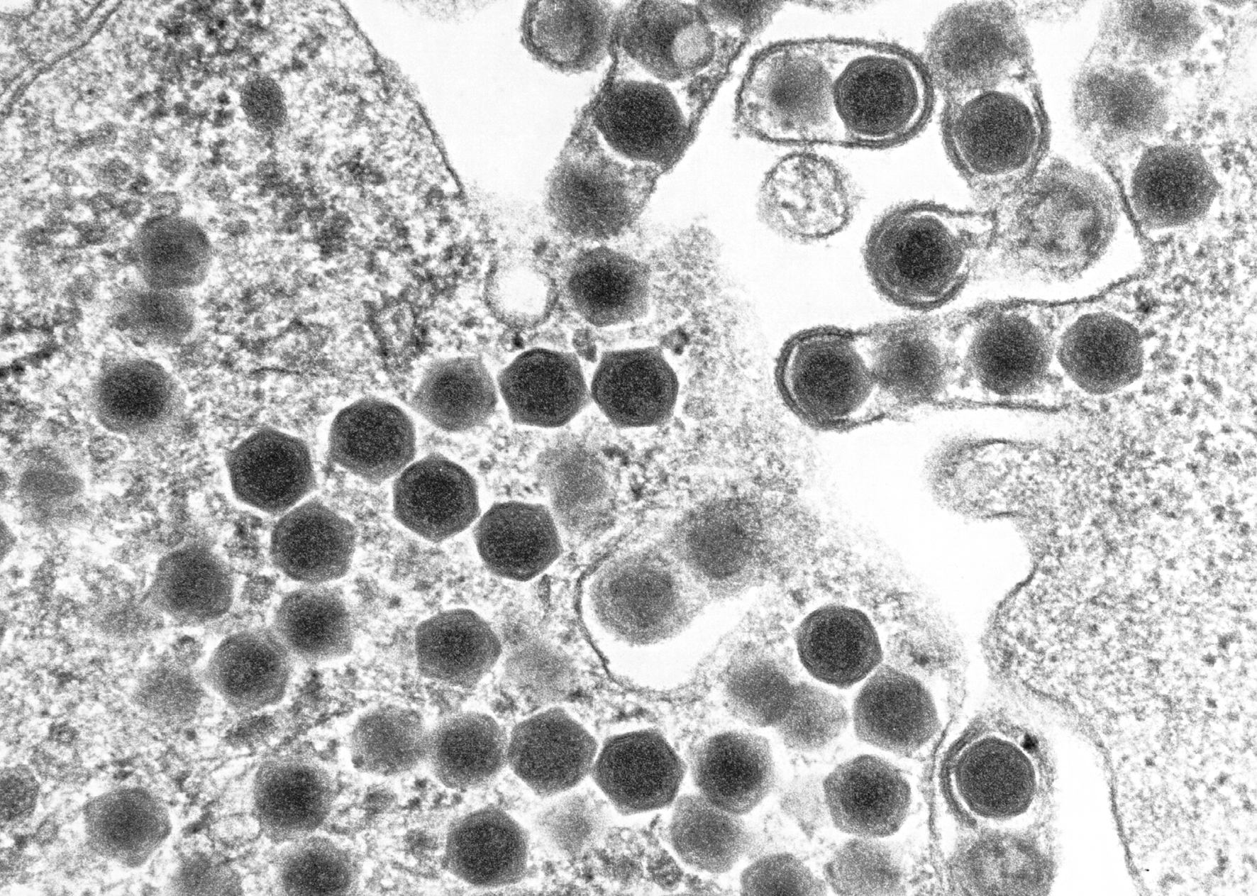 Los Ranavirus son un género de virus de ADN bicatenario (Grupo I según la clasificación de Baltimore) pertenecientes a la familia Iridoviridae. Son virus que se aislaron en ranas de EE.UU., y están afectando a las poblaciones europeas. La gravedad reside en que está afectando a las poblaciones de otros grupos como pueden ser salamandras y tritones, bioindicadores de la calidad del agua en parajes naturales.