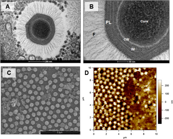 Los mimivirus conforman un género de virus de gran tamaño (400-500 nm de diámetro) y ADN de doble cadena. En la imagen se muestra el aspecto del mimivirus de Acanthamoeba polyphaga. Partícula Mimivirus visualizada por diferentes métodos de microscopía.