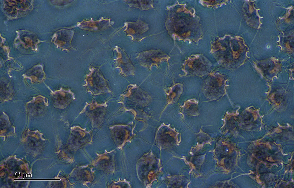 Cultivo de Tritrichomonas foetus al microscopio de contraste de fase negativa.