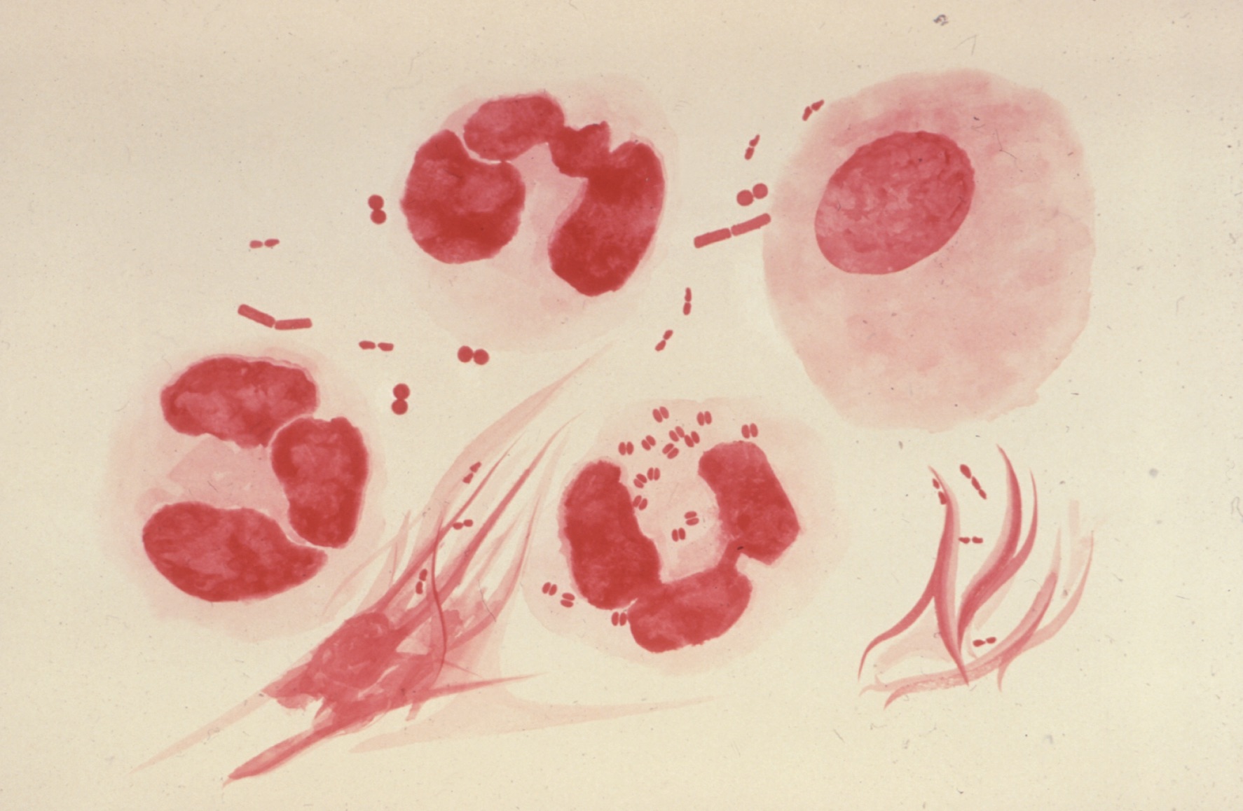 Neisseria gonorrhoeae, agente causal de la gonorrea
Microfotografía de un exudado uretral que reveló la presencia de Neisseria gonorrhoeae. El paciente tenía uretritis gonocócica, y en ella podemos observar diplococos intracelulares típicos, así como extracelulares pleomórficos y organismos gram negativos.
Fuente: CDC/ Dr. Norman Jacobs