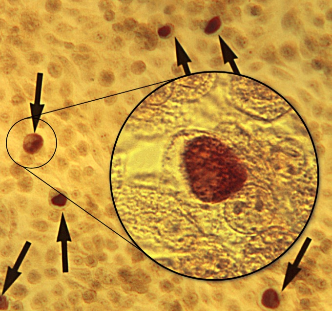 Aumento 50X de una monocapa de células de McCoy. En ella podemos observar algunos cuerpos de inclusión de Chlamydia trachomatis que representa la fase de replicación de estos organismos. Es decir, el cuerpo reticulado reorganizado se multiplica por fisión binaria dando lugar a entre 100 y 500 nuevos cuerpos reticulados. Es el causante de la enfermedad llamada clamidia, una infección de transmisión sexual muy común. En otra imagen podemos ver estos mismos cuerpos a 200X
Fuente: CDC/ Dr. E. Arum; Dr. N. Jacobs