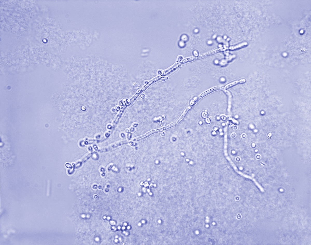 Candida albicans, agente etiológico de la candidiasis
En la imagen podemos ver al hongo Candida albicans con un aumento de 500X en un raspado de piel con hidróxido de potasio (KOH).
Fuente: CDC/ Dr. Lucille K. Georg