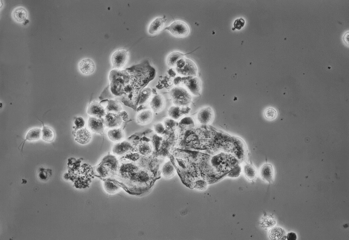 Trichomonas vaginalis son parásitos protozoos, de una micrografía de una muestra de descarga vaginal. Son las causantes de la enfermedad de transmisión sexual llamada tricomoniasis. Los síntomas que ocasionan son variados, aunque a veces tanto en el hombre como la mujer pasan asintomáticos.Fuente: CDC/ Joe Miller