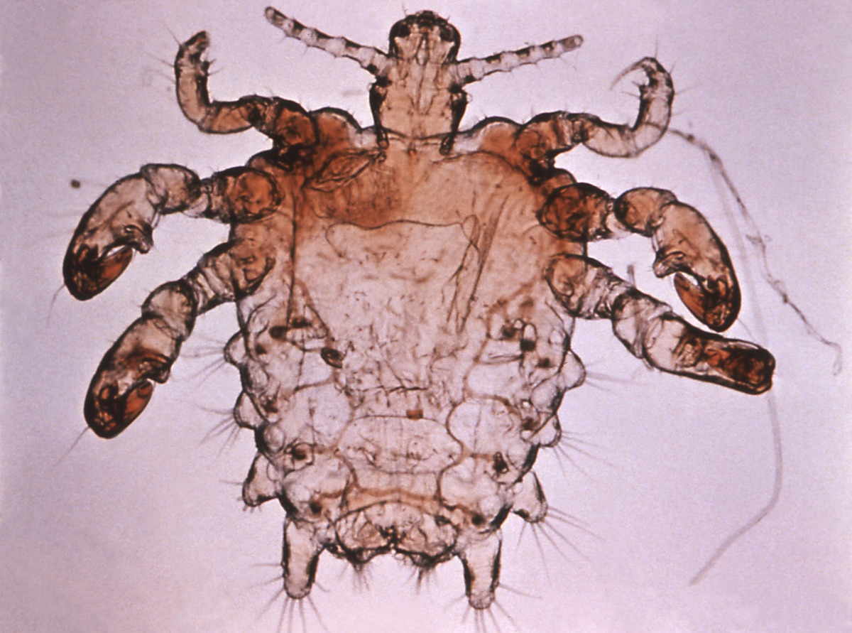 Phthirus pubis, o más comúnmente conocido como ladilla. Son insectos anopluros ectoparásitos de seres humanos. Miden entre 1 y 3 mm, de color amarillento. Las ladillas se transmiten de persona a persona a través del contacto sexual directo, infestando la región del vello púbico en adultos, este proceso se conoce como ftiriasis. En raras ocasiones se transmite al compartir prendas infectadas. Se estima que ocurren más de 1 millón de casos al año, y el riesgo aumenta al aumentar las relaciones con diferentes personas. Fuente: Organización Mundial de la Salud (OMS) 