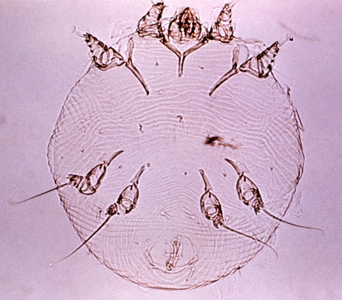 Sarcoptes scabiei var. hominis. Se trata de un ácaro de la familia Sarcoptidae. Tiene un cuerpo con forma ovoidal, no segmentado y 4 pares de patas. Las hembras son mayores que los machos, las primeras, mide como máximo 450 micras; mientras que los mayos puede alcanzar las 250 micras. Producen la enfermedad llamada sarna y fuera de us huésped no vive más de 4 días. Fuente: CDC/ Donado por la OMS, Geneva, Switzerland