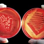 Bacterias y otra microbiota intestinal