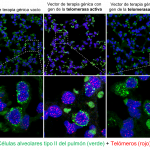 Imágenes de pulmones tratados con los vectores de terapia génica en las que se observan los núcleos de las células en azul, las células alveolares en verde y los telómeros en rojo. Se observan que los telómeros de las células de pulmón a los que se les ha tratado con la telomerasa activa son más intensos indicando mayor longitud telomérica que las células de pulmones tratados con los vectores vacíos o con la telomerasa inactiva. / CNIO