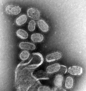 Virus influenza, a 100.000 aumentos
