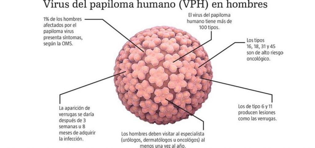 Imagen informativa sobre algunas de las consecuencias del VPH en el género masculino.