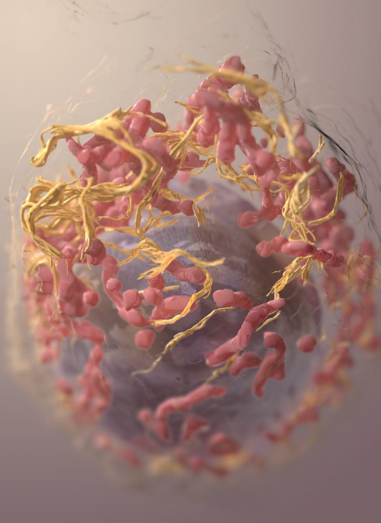 melanoma cáncer de tipo carcinoma