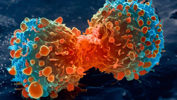 cáncer y la apertura de la cromatina