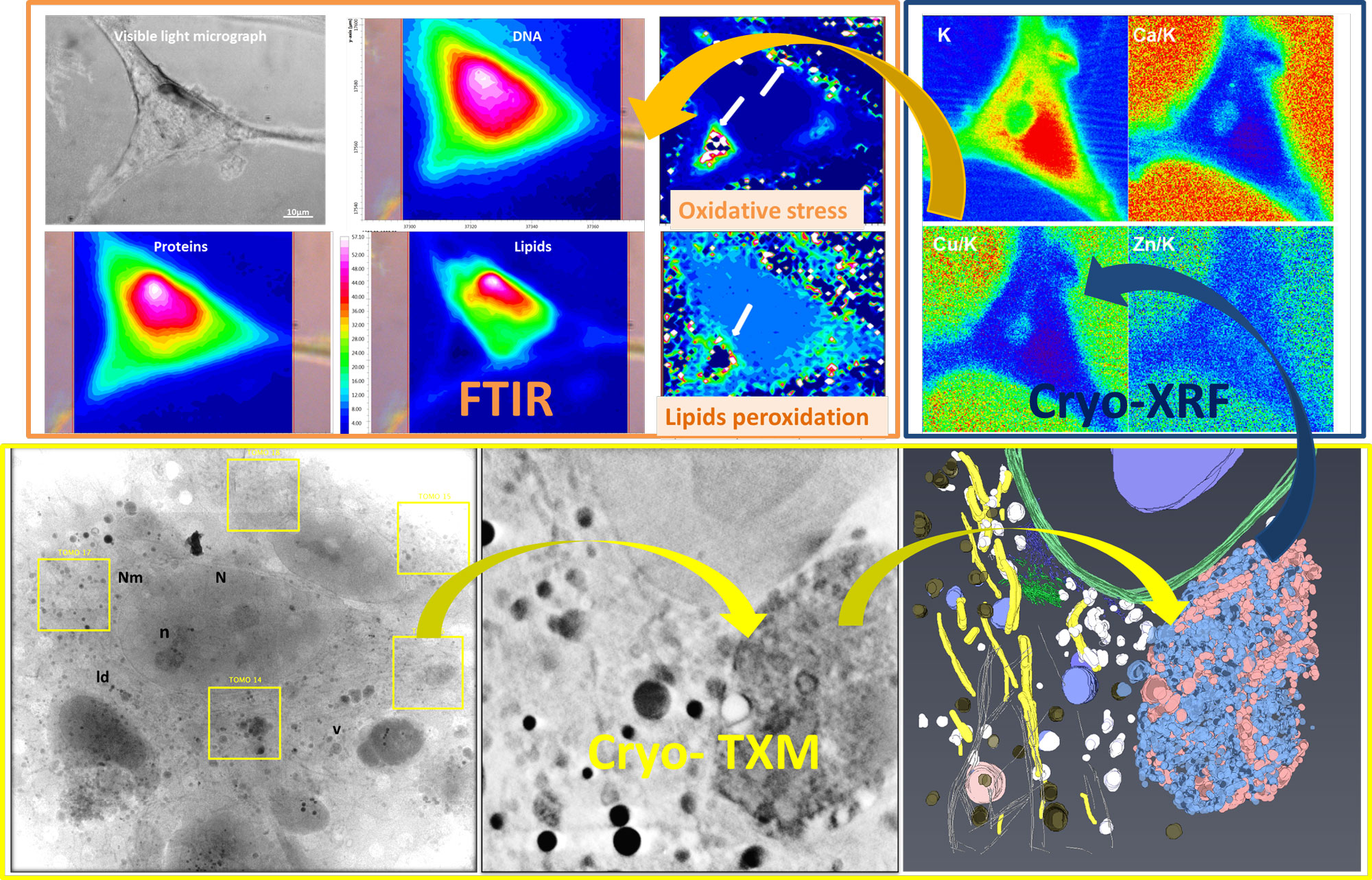 Resultados de la combinación de técnicas basadas en luz de sincrotrón donde se analizan astrocitos intactos del modelo animal transgénico hSOD1 G93A de esclerosis lateral amiotrófica (ELA). Arriba a la izquierda, los datos de micro-espectroscopia de infrarrojo mediante transformada de Fourier indican el estrés oxidativo en los astrocitos. Arriba a la derecha, mapas de crio-fluorescencia de rayos X muestran la distribución de metales. Debajo, la tomografía de rayos X y su reconstrucción 3D muestran los cambios estructurales.