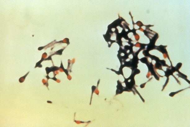 Bacterias de Clostridium tetani, causante del tétanos