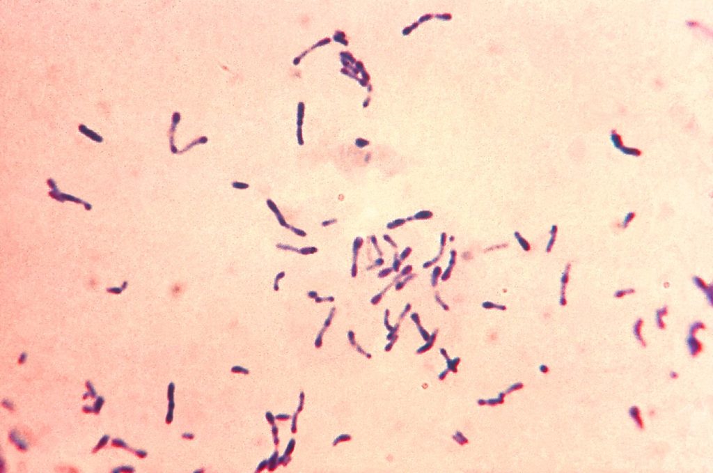 Difteria. Corynebacterium diphtheriae