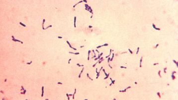 Difteria. Corynebacterium diphtheriae