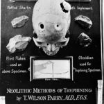 Métodos de trepanación neolíticos de la historia de la neurofisiología
