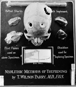 Métodos de trepanación neolíticos de la historia de la neurofisiología