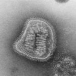Imagen a microscopio electrónico de transmisión se puede ver una partícula completa de influenzavirus o virus de la gripe, observándose una cápsula con multitud de proteínas en su superficie