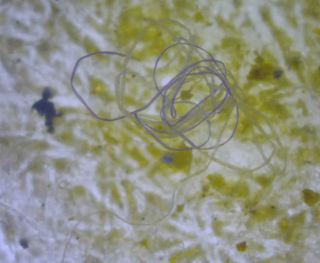 Microplásticos: Fibras microplásticas en ecosistema marino.