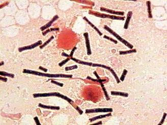 Bacteria Bacillus anthracis, causante del carbunco o ántrax en una muestra de sangre de oveja