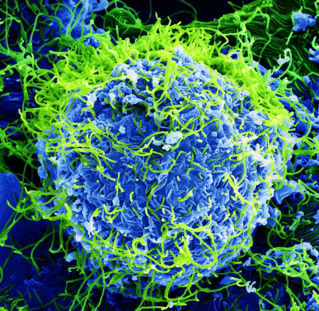 Miles de copias del virus del Ébola (verde) se encuentran en el espacio extracelular de una célula infectada (azul).