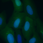 Células de un tumor humano con un marcador fluorescente de autofagia. Las punteaduras verdes brillantes en la célula son autofagosomas.